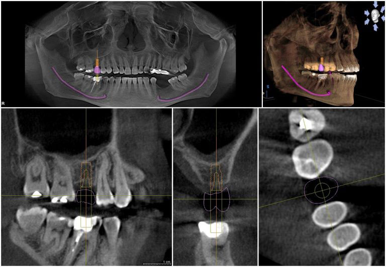 The image is a collage of six photographs showcasing different views and angles of a human skull with a focus on dental structures, including teeth, gums, and the upper and lower jaws.