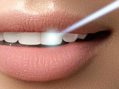 The image shows a close-up of a person s lips with a focus on a toothpaste or dental care product, indicated by the blue light and text.